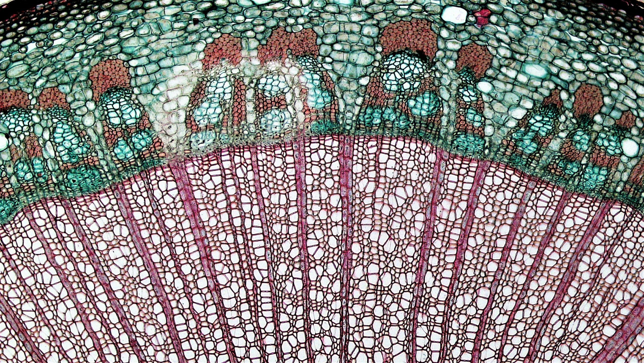 Multiseriate Medullary Rays in Woody Dicot Stem of Liriodendron